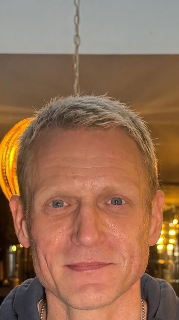 Male client after facial balancing