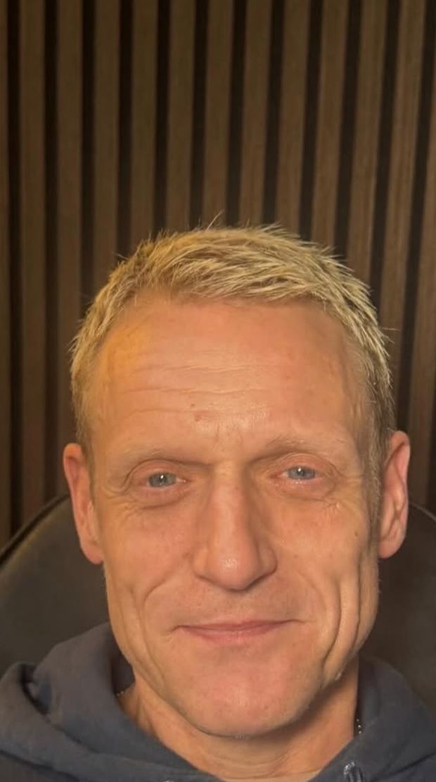 Male client before facial balancing